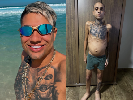 influenciador-jota-surfista,-que-lutava-contra-cancer-e-cirrose,-morre-aos-30-anos