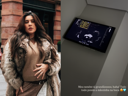 lauana-prado-mostra-ultrassom-do-filho-e-atualiza-evolucao-de-dom:-“esta-grandao”