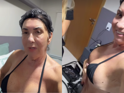 mae-de-virginia-exibe-corpo-apos-30-dias-de-cirurgias-e-comemora-com-novo-procedimento