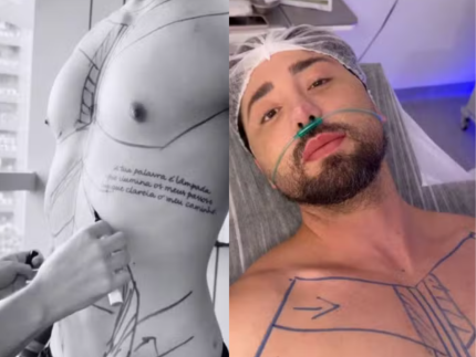 “eu-sou-do-centro-cirurgico”:-rico-melquiades-detalha-novos-procedimentos-de-r$-150-mil