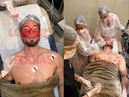 rico-melquiades-passa-por-novo-procedimento-estetico-e-supreende;-veja-fotos