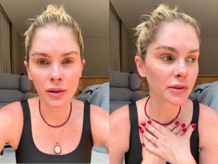 apos-anos-de-uso,-barbara-evans-relata-luta-contra-a-dependencia-de-remedio-para-dormir