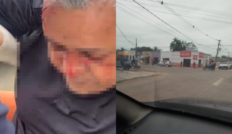 iclista fica ferido em acidente próximo ao hospital de Sena Madureira