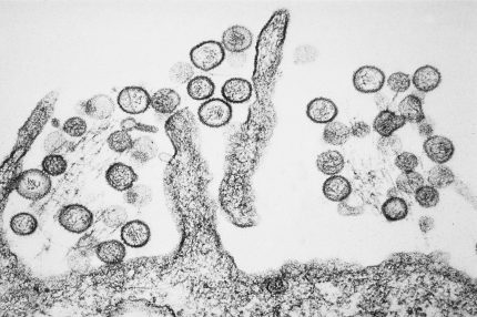 hantavirus:-oms-faz-alerta-sobre-novos-casos-e-esclarece-se-ha-risco-de-pandemia