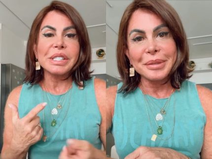 gretchen-desabafa-sobre-alopecia-e-revela-real-causa-da-queda-de-cabelo