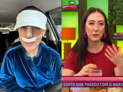 reporter-do-“mais-voce”-faz-alerta-apos-quase-perder-nariz-por-erro-em-procedimento-estetico