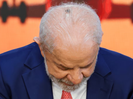 lula-passa-por-consulta-medica-apos-retirada-de-lesao-na-cabeca