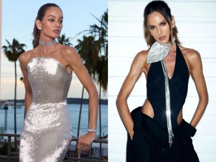 izabel-goulart-surge-com-rosto-diferente-apos-suposto-procedimento-e-web-reage