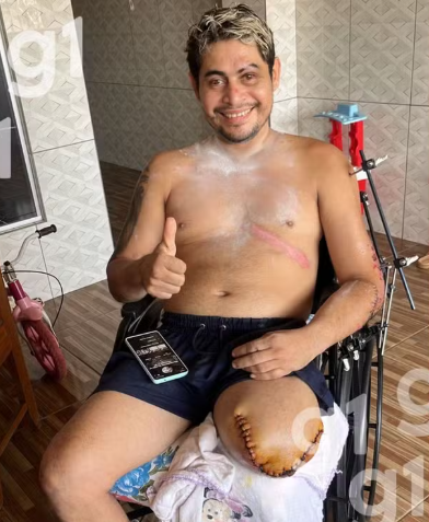 Motociclista acidentado enfrenta dificuldade financeira