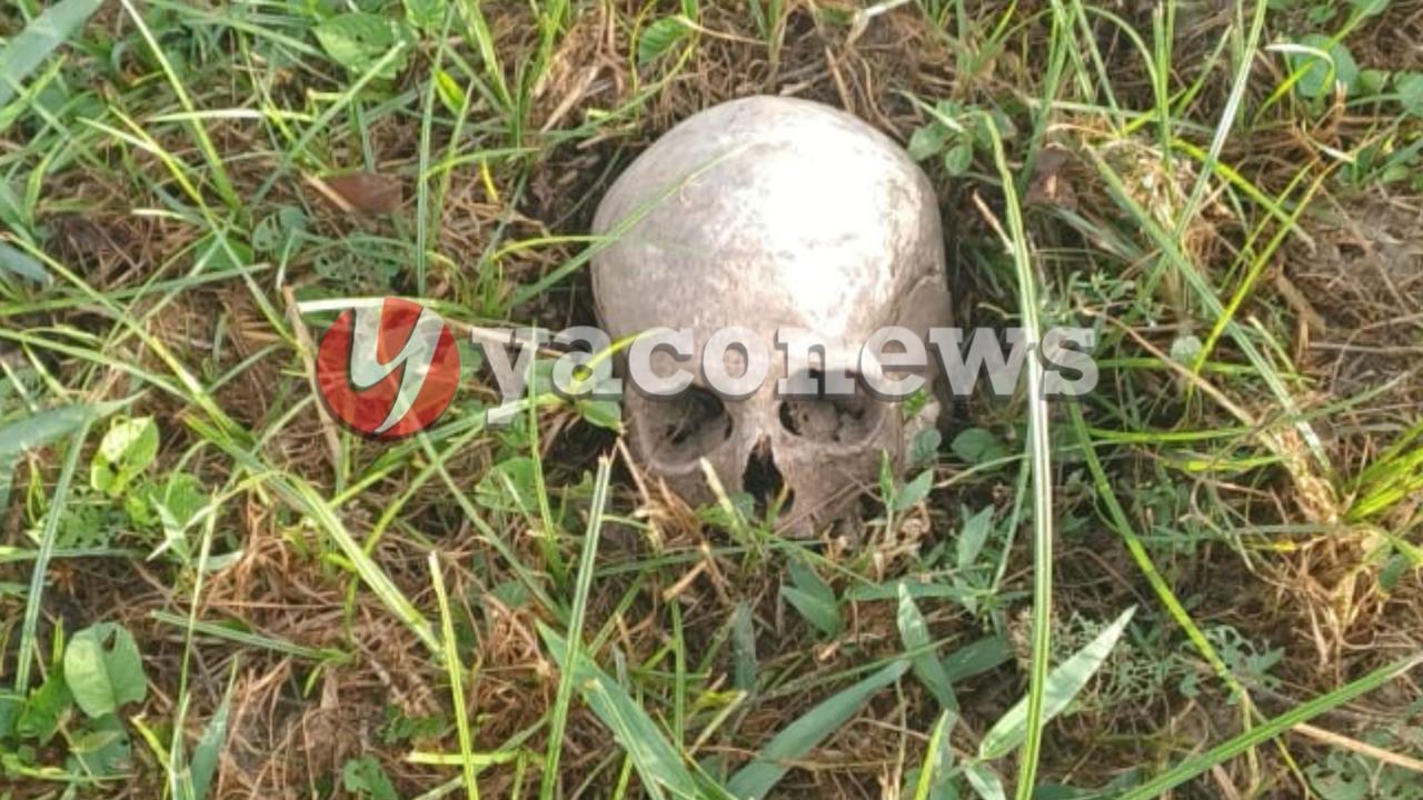 Crânio humano visto em via pública some após polícia ser chamada para atender a ocorrência no interior do Acre