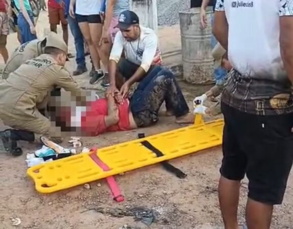 Idoso fica ferido em atropelamento por motocicleta em Sena Madureira