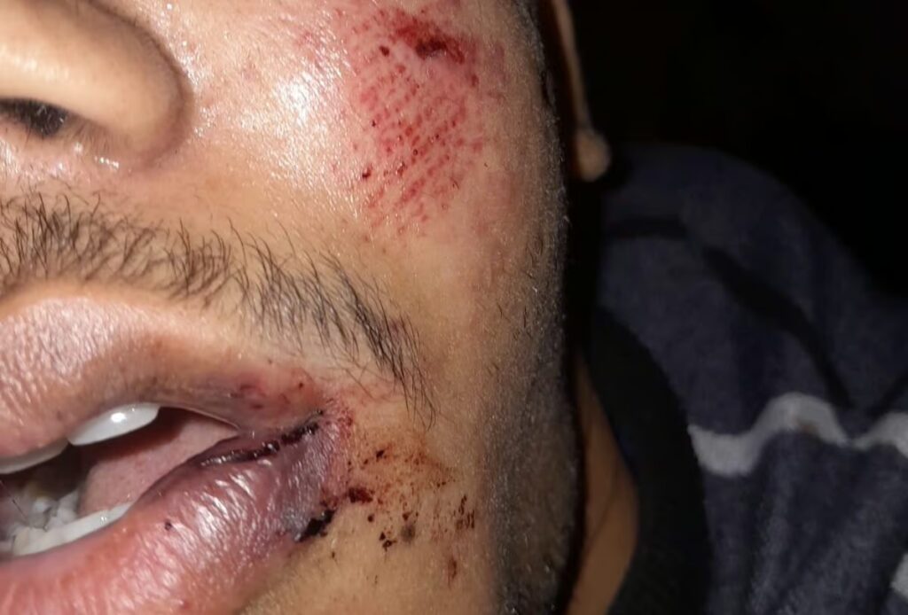 Estudante de 17 anos é agredido na saída de escola após sofrer bullying em Brasiléia.