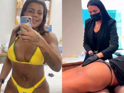 Tati Quebra Barraco faz harmonização no bumbum e brinca: “Prefiro a faca!”