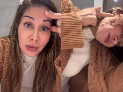 Após relato de Maíra Cardi, especialista alerta para riscos do PMMA: “Pode causar deformidades”