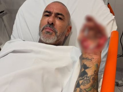 Henrique Fogaça expõe feridas de acidente e revela roubo de aliança em hospital