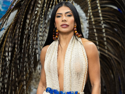 Ex-BBB Marciele relembra diagnóstico de alopecia após Festival de Parintins: “Nunca mais”