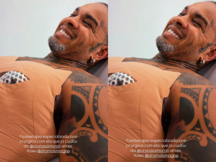 Rodriguinho passa por cirurgias plásticas após emagrecer mais de 20 kg