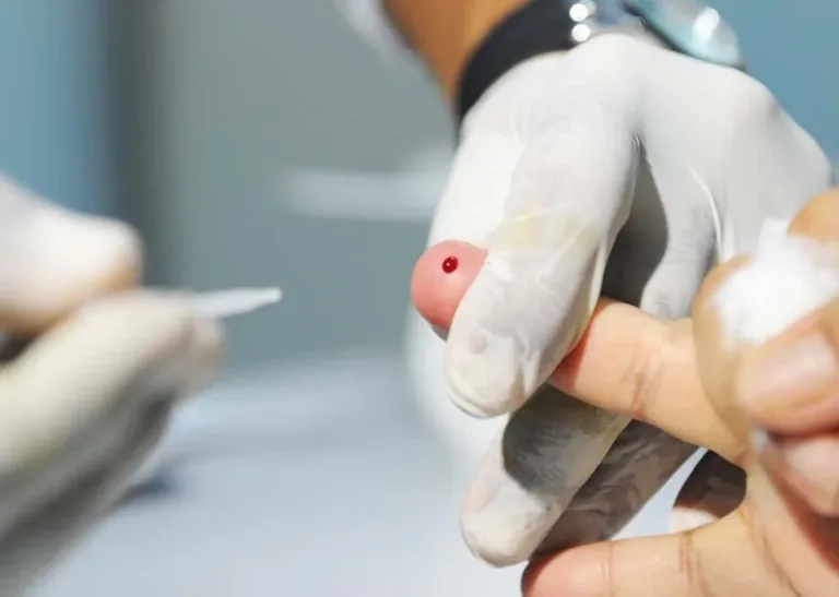 Acre está entre estados com mais internações por hepatites virais segundo o DataSUS.