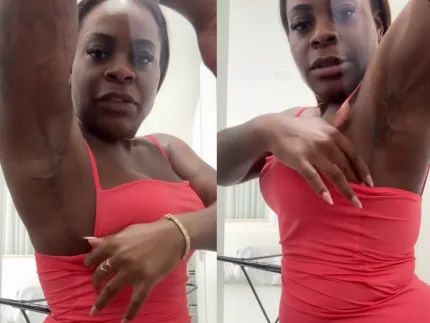 Jojo Todynho mostra cicatrizes de novo procedimento cirúrgico após emagrecimento