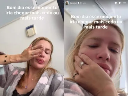 Karoline Lima chama atenção para pele, mas detalhe rouba a cena