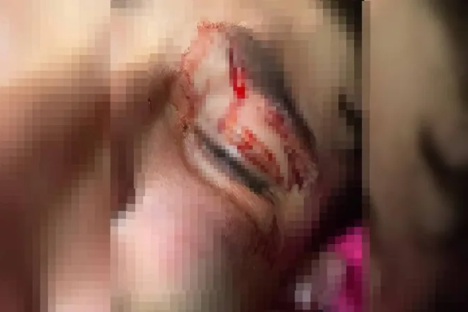 "Achou que ia morrer", diz mãe de adolescente espancado por PM em GO