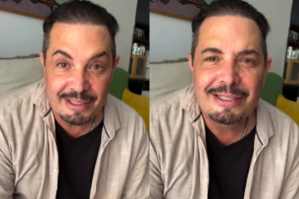 Conrado faz harmonização facial e muda o visual; veja o antes e depois