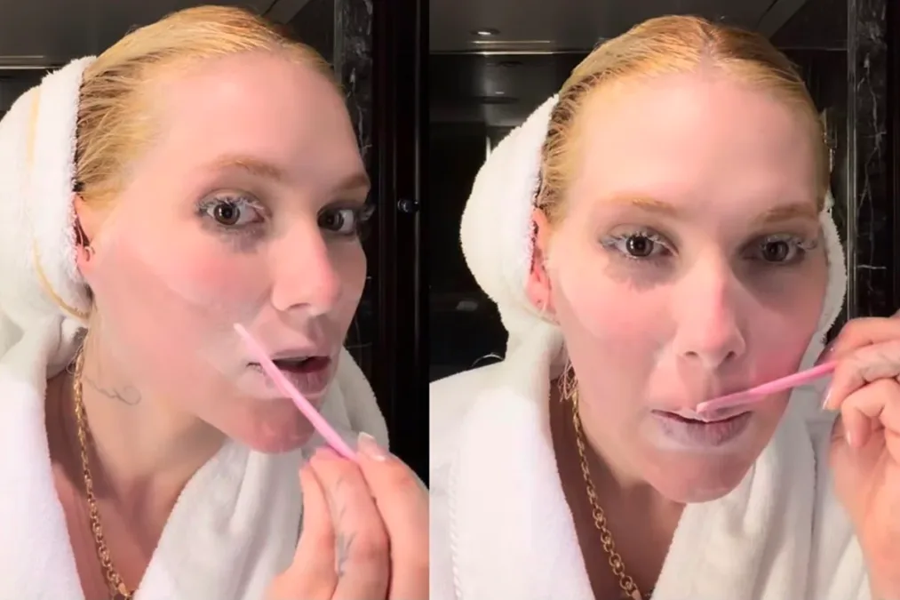 Depilação facial de Virginia: especialista esclarece cuidados e riscos
