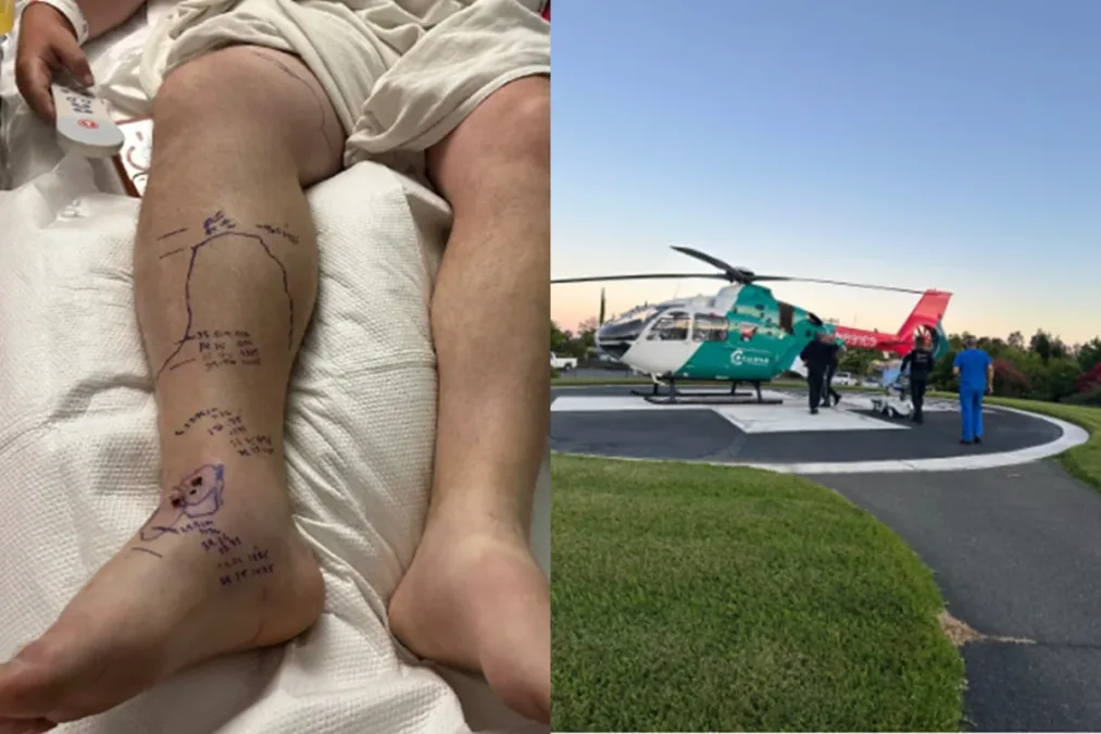 Homem leva duas picadas de cascavel e esgota o soro de hospital