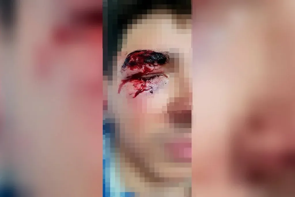 Jovem teve óculos quebrados por soco de morador de rua em Águas Claras