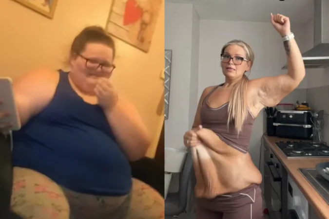 Mãe de 2 filhos mostra antes e depois de perder 152 kg: "Vitória"