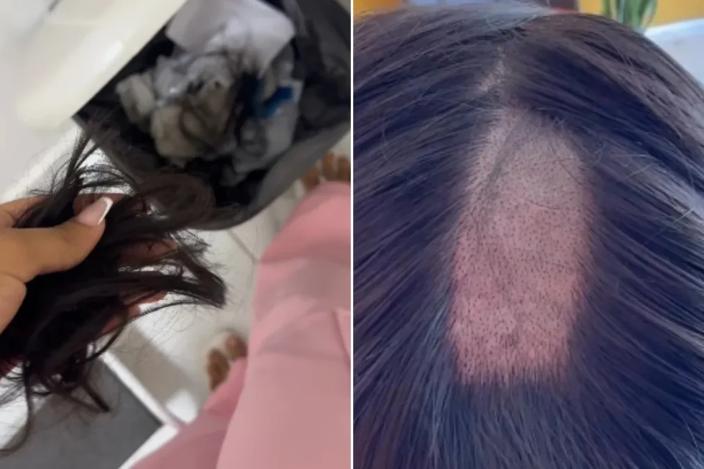 Mulher denuncia clínica após ter cabelo raspado em exame para CNH