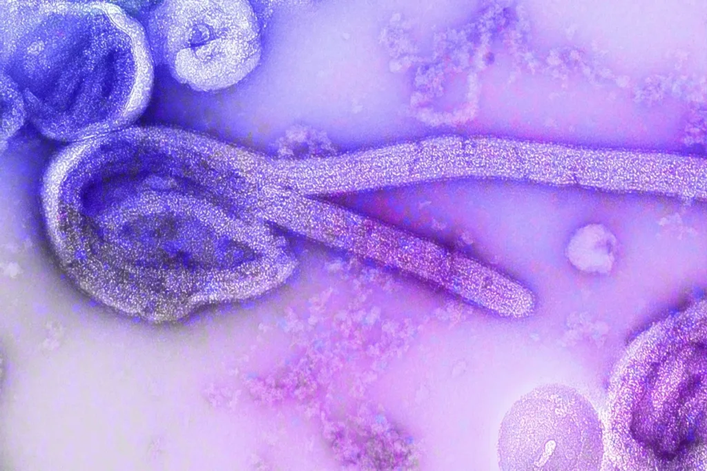 Uganda é declarada livre do ebola enquanto surto segue no Congo