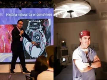 Médico brasileiro desenvolve “Teoria do Polvo” para explicar dores causadas por endometriose