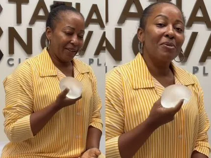 Tia Má revela cirurgia para retirar silicone após descobrir nódulos: “Muito medo”