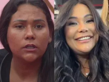 Ex-BBB Chaiany muda visual após harmonização e exibe resultado: “Nunca me amei tanto”