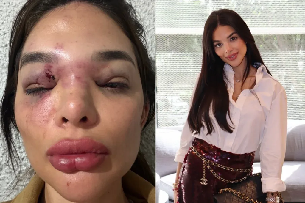 Empresário da Faria Lima é preso em flagrante por violência doméstica