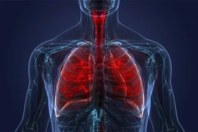 Medica do Acre celebra aprovacao de tratamento inedito contra fibrose pulmonar.