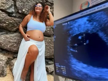 Em dose tripla! Mulher engravida de 3º bebê durante gestação de gêmeos no RJ
