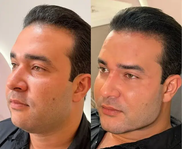Juh Vellegas mostra harmonização facial do marido e brinca: “gato de verdade”
