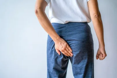 Hemorroida não impede sexo anal; veja cuidados para uma prática segura