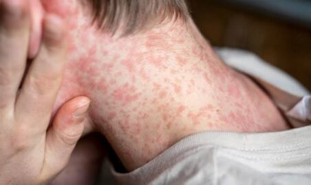 Rio Branco tem 30 vagas gratuitas para curso de Atendente de Farmacia no Senac.