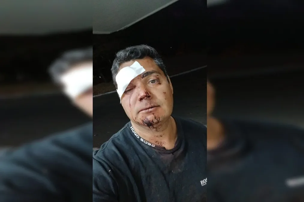 Irmãos são agredidos com socos e chutes ao tentar usar banheiro em bar