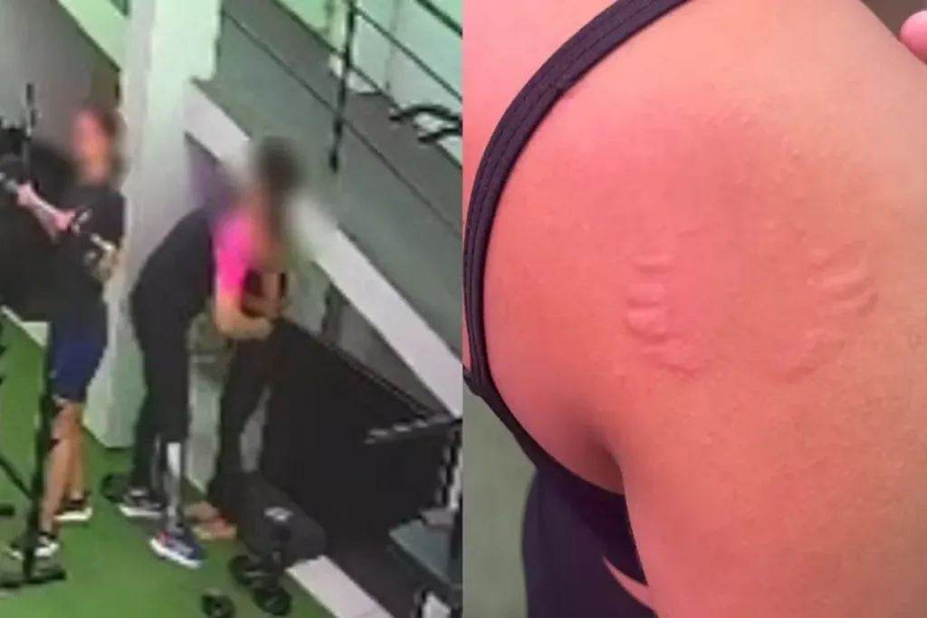 Mulher é assediada ao ser agarrada e mordida por instrutor em academia