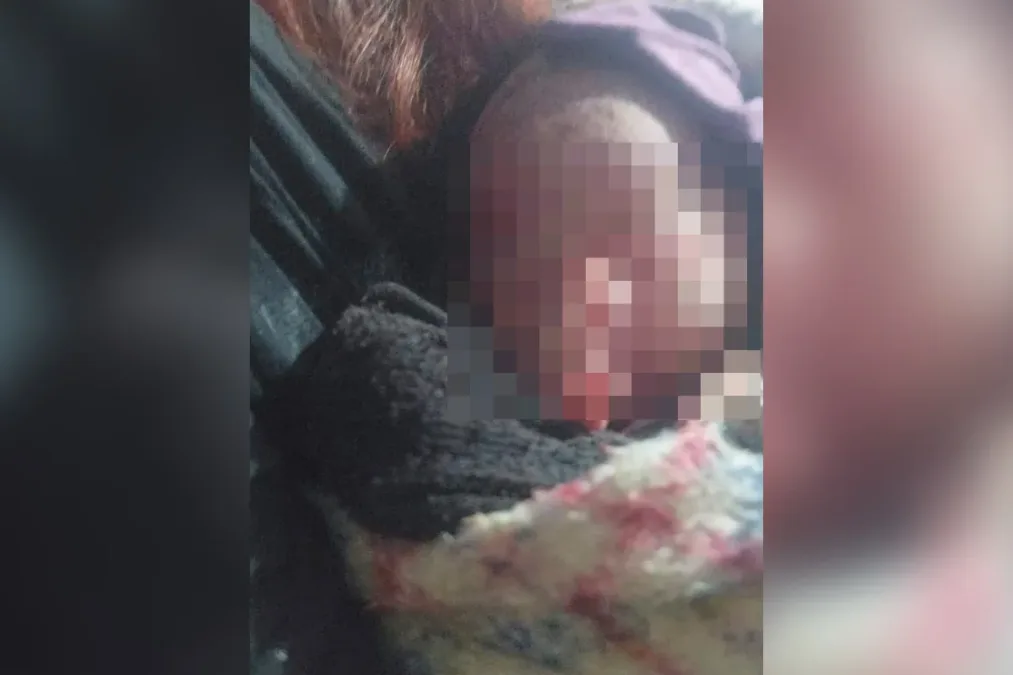 Mulher encontra recém-nascida no lixo: "Achou que era o gato chorando"