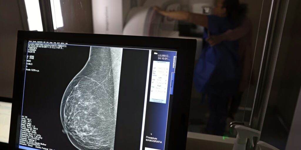 Plano de saúde terá que cobrir mamografia digital para todas as idades