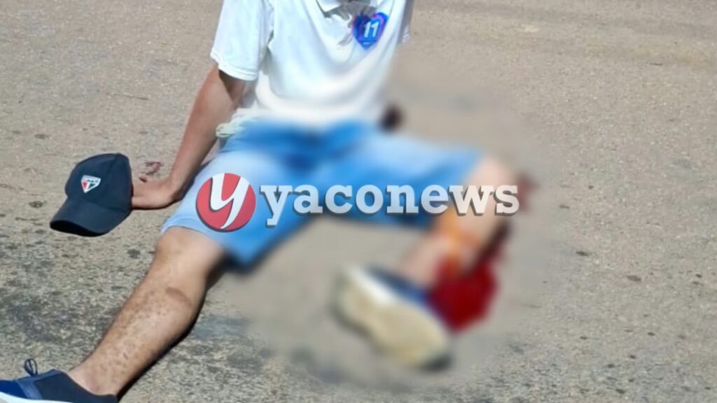 Adolescente atropelado por motociclista em Brasileia sofre fratura grave na perna.