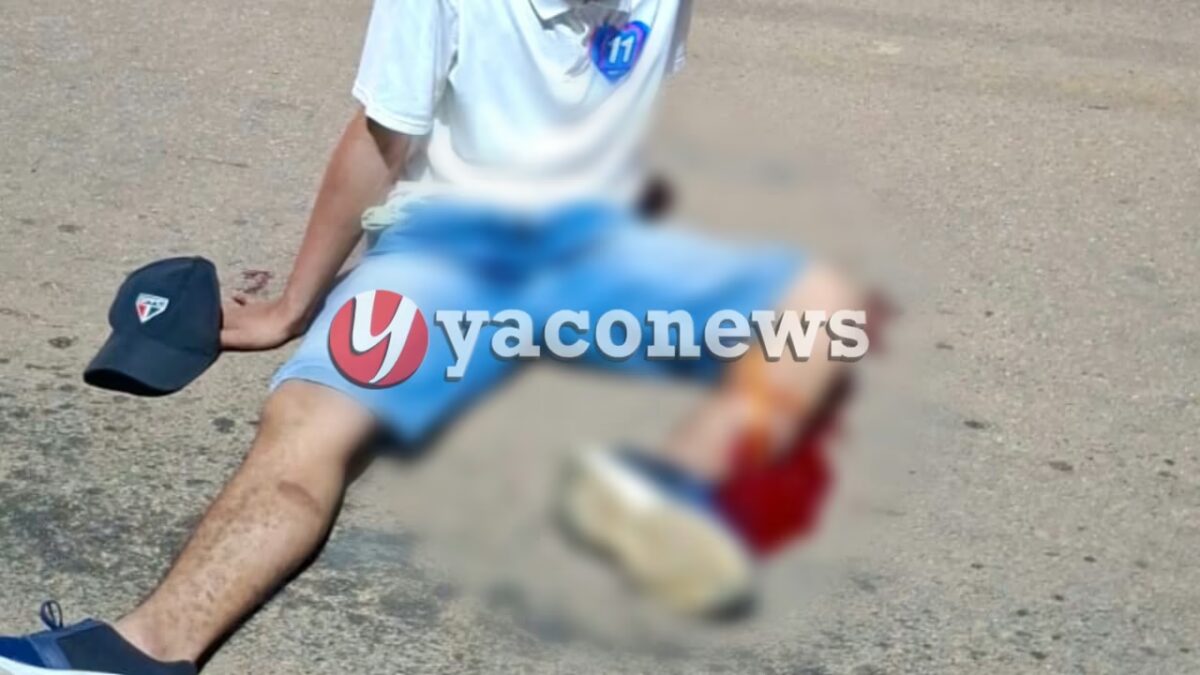 Adolescente sofre fratura grave na perna após ser atropelado por motociclista em Brasileia