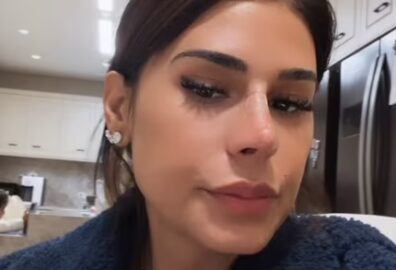 Rinoplastia? Simone Mendes explica mudança no nariz e revela procedimento realizado