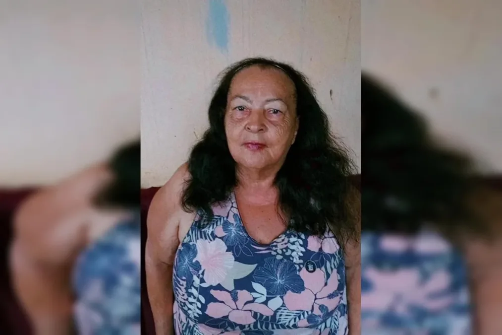 Após esperar na chuva por maca, idosa morre em hospital no Entorno do DF