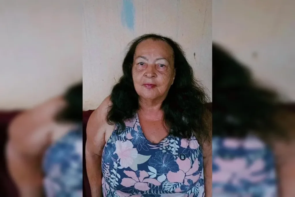 Após esperar na chuva por maca, idosa morre em hospital no Entorno do DF
